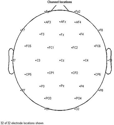 Brain functional connectivity analysis in patients with relapsing-remitting multiple sclerosis: A graph theory approach of EEG resting state